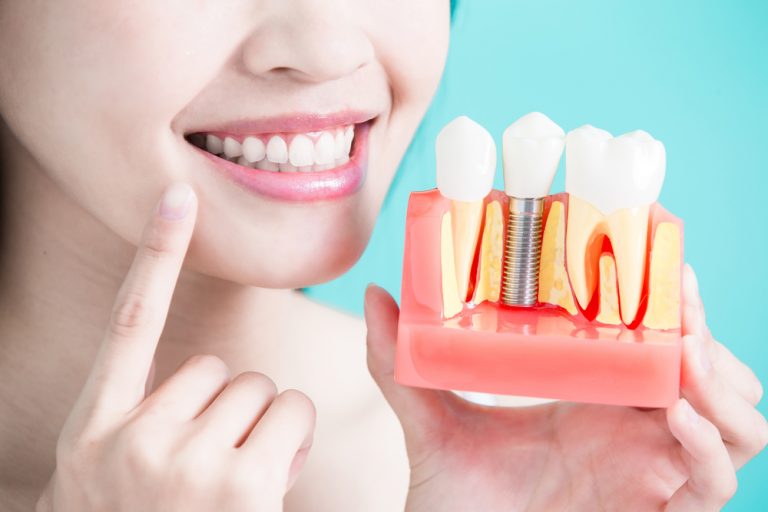 Benefits Of Dental Implant Healing Cap Restore Dental Implants