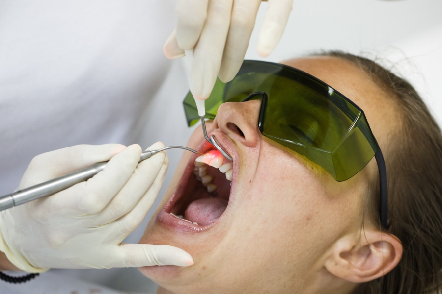 Laser Treatment For Gum Disease