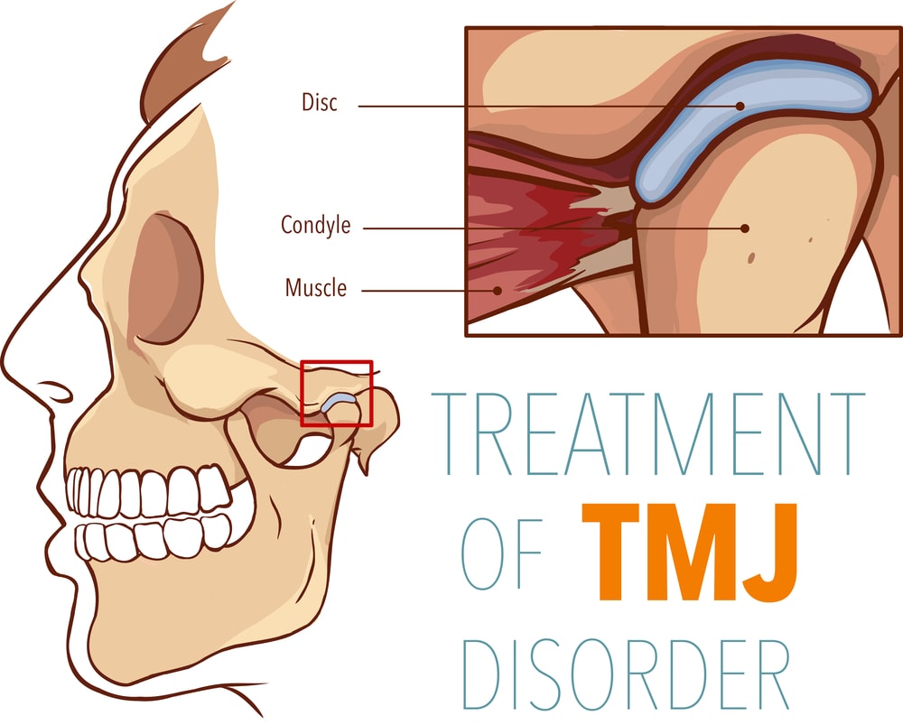 TMJ disorder treatment