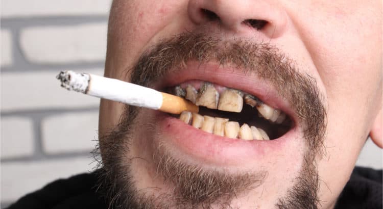 Tobacco Cause Dental Problems